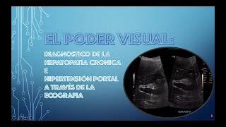 EL PODER VISUAL DIAGNOSTICO ECOGRAFICO DE LA HEPATOPATIA CRONICA E HIPERTENSION VENOSA PORTAL [upl. by Acisej]