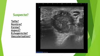 Les 6 points clés dune adénopathie suspecte en échographie [upl. by Dorrehs]