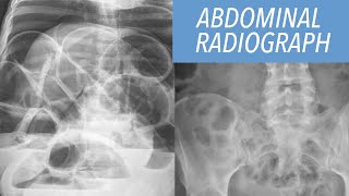 Abdominal Radiograph Made Easy [upl. by Netsriik562]