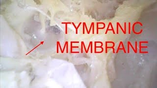 TYMPANIC MEMBRANE [upl. by Masterson]