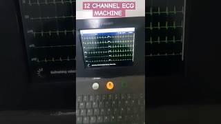 12 CHANNEL ECG MACHINE DEMO  MEDICAL EQUIPMENT  ECG MACHINEshortsviral shotrs [upl. by Roi]