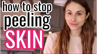 How to STOP PEELING SKIN Dr Dray [upl. by Ecirtnahs36]