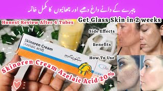 Skinoren Cream Uses and Benefits  How To Use Skinoren Cream  Azelaic Acid Cream Review [upl. by Jessy]