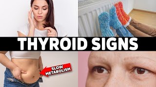 HYPOTHYROIDISM Don’t Ignore These 7 Early Warning Signs [upl. by Leruj]