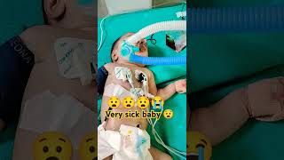 😧 ventilator Meachine support baby ⚕️😧😧😧😭 [upl. by Akins]