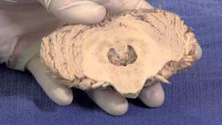 The Cerebellum Neuroanatomy Video Lab  Brain Dissections [upl. by Ahsena173]