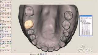 SensAble FreeForm Software Orthodontia Aligners  Dental Braces [upl. by Ahseuqram]