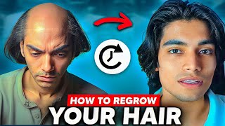 Loosing hairs  50x worse life  How To Stop Hair fall in men  How to fix male pattern baldness [upl. by Koch]