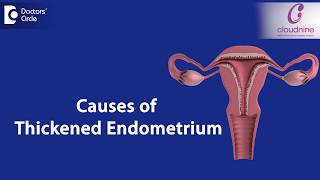 What causes Endometrial thickness  DrSmitha Sha of Cloudnine Hospitals  Doctors Circle [upl. by Treb]