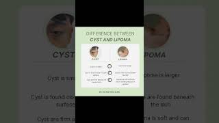 Cystic Acne vs Lipoma acne jerawat drlyna prplututdrlyna prplututklinikprimernilampuri [upl. by Liagaba]