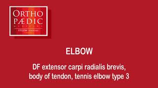 Transverse friction massage tennis elbow type 3 [upl. by Setiram]