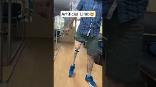 🤯😱Above Knee Prosthesis  Pneumatic Knee Joint  Amputation  disability artificiallimb sports [upl. by Burris474]