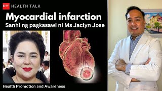 Myocardial infarction Sanhi ng pagkasawi ni Ms Jaclyn Jose [upl. by Gleda]