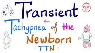 Transient Tachypnea of the Newborn TTN  Pediatrics  5Minute Review [upl. by Alletsyrc]