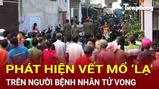 Bản tin thời sự  Phát hiện vết mổ ‘lạ’ trên người bệnh nhân tử vong Công an khẩn cấp vào cuộc [upl. by Ahsilyt347]