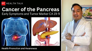 Cancer of the Pancreas Early symptoms and tumor marker CA 199 [upl. by Assereht]