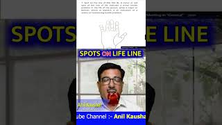 SPOTS ON LIFE LINE anilkaushal58 astrologer palmistry earproblem hastrekha palmist palmlines [upl. by Hachman]