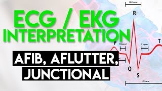 Afib Aflutter Junctional Arrhythmias  ECG EKG Interpretation Part 4 [upl. by Gavin]