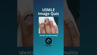 ⬆️More high yield USMLE here  📌Answer in comments usmle usmlestep1 medstudent medschool shorts [upl. by Llorre720]