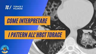 Come interpretare i pattern allHRCT torace  parte 1 [upl. by Omik]