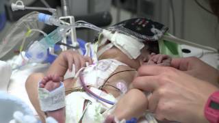 PICU Nursing at Childrens  Jericas Story [upl. by Adnarb]