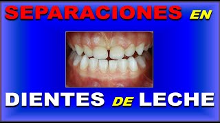 ESPACIOS INTERDENTALES EN DENTICION TEMPORAL  PRIMATES LEEWAY SPACE NANCE DERIVA INTERINCISALES [upl. by Adah]