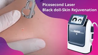 Pro Mole Removal Picosecond Laser Skin Whitening Machine [upl. by Alat348]