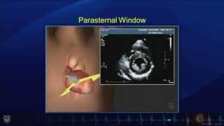 Echo Tutorial Comprehensive Transthoracic Echocardiogram  Mayo Clinic [upl. by Yrtnej720]