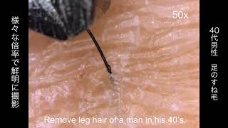 Plucking leg hair under microscope  GOKO EV6HD  Made in Japan [upl. by Chivers]