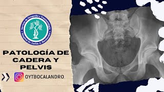 Patología de Cadera y Pelvis Dr Veneri UBA [upl. by Westbrook]