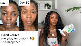 Cerave is clearing my acne prone skin and scars dark spots hyperpigmentation  1 month review [upl. by Judson47]