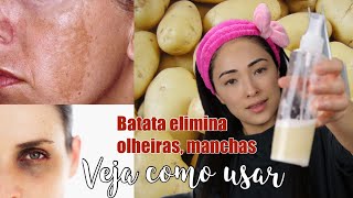 DICA COMO USAR BATATA PARA ELIMINAR OLHEIRASCLAREAR MANCHASDEIXAR SUA PELE DE PORCELANA [upl. by Tung343]