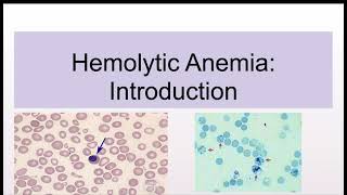 Hemolytic Anemias Introduction and Classification [upl. by Romanas]