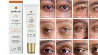 Sesderma CVIT Eye Contour Cream [upl. by Eellac928]