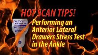 Hot Tip  Performing an Anterior Lateral Drawers Stress Test in the Ankle [upl. by Nillok484]