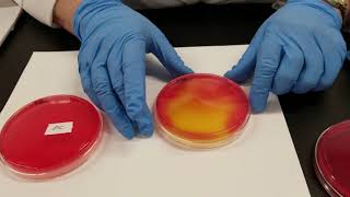 Staphylococcus Results [upl. by Noet]