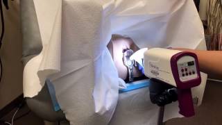 Colposcopy training video [upl. by Seed]