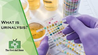 What is urinalysis [upl. by Cchaddie]