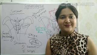 FEMALE PELVIS  GYNAECOLOGICAL NURSING EASY EXPLANATION [upl. by Ahsiemat]