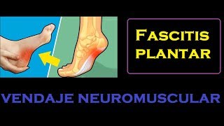 Fascitis plantar  vendaje neuromuscular [upl. by Tatiania]