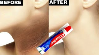 Colgate toothpaste for neck whitening  How to remove black neck with colgate  Colgate on neck [upl. by Ardnekan]