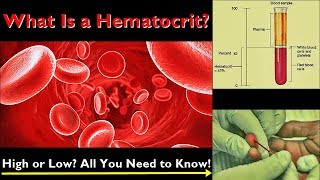 Hematocrit – Normal Range Low and High Levels Causes [upl. by Nairda928]