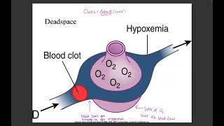 Unit 4 Respiratory [upl. by Loree]