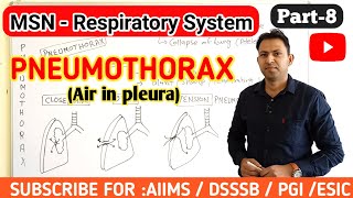 Pneumothorax  causes symptoms pathophysiology treatment of pneumothorax  respiratory msn part8 [upl. by Bishop]