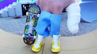 FINGER SKATEBOARD  OMG I GOT INJURED  Wheel Chair Tricks  Tech Deck  Fingerboarding [upl. by Kall]