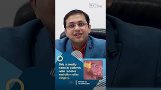 Facial Wounds After Buccal Mucosa Cancer Treatment Causes and Solutions  Dr Amit Chakraborty [upl. by Atinet]