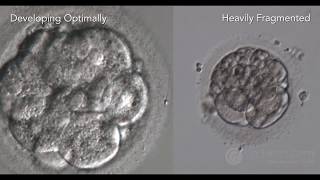 Optimal Embryo Development and Assessment [upl. by Ynettirb]