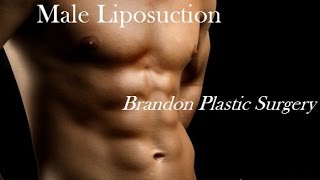 Lakeland Male Liposuction Marvin F Shienbaum MD FL [upl. by Eladroc481]