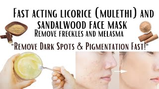 Remove Melasma Freckles Dark Spots and Hyperpigmentation FastquotNatural DIY Fast acting face mask [upl. by Sue433]