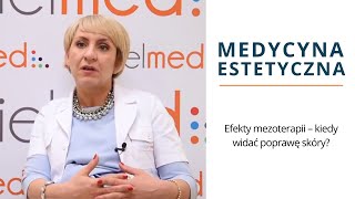 Efekty mezoterapii – kiedy widać poprawę skóry [upl. by Atinauq]